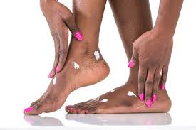 Uncrack Your Heels
